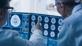 Angleterre : Une IA accélère le diagnostic des AVC